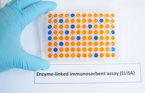 Enzyme-linked Immunosorbent Assay Principle and Elisa Test Procedures.